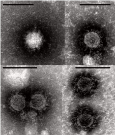 El virus Chikungunya, Sintomas