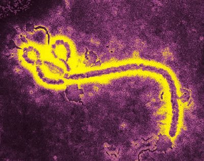 Fiebre Hemorrágica del Ébola